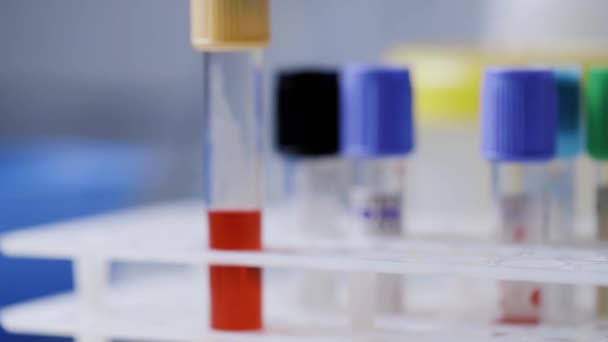 Пробірка Крові Позитивним Тестом Коронавірус Лабораторії — стокове відео