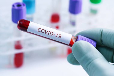 covid-19 - Laboratuvarda koronavirüslü test tübü