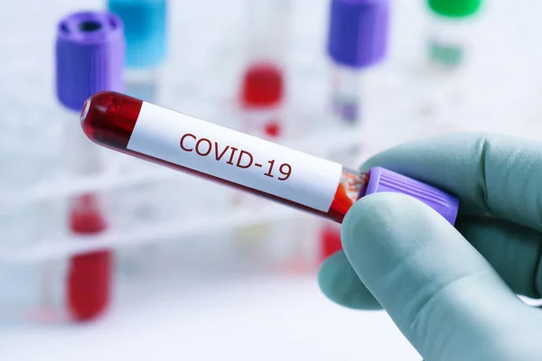 Covid Test Sample Tube Coronavirus Lab — Stock Photo, Image