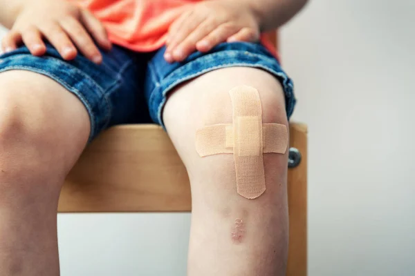 Barn Knä Med Självhäftande Bandage Och Blåmärken — Stockfoto