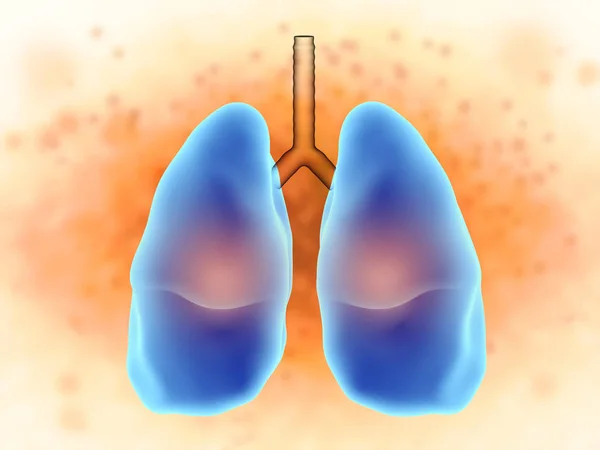 Lungs in pain — Stock Photo, Image