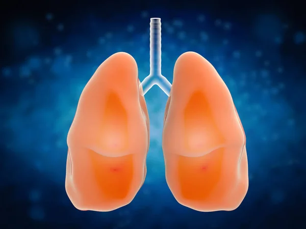 Lungs in pain — Stock Photo, Image