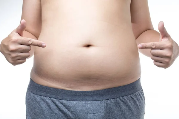 Sobrepeso homem com barriga gorda — Fotografia de Stock