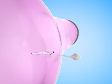 sperm ile kırık prezervatif