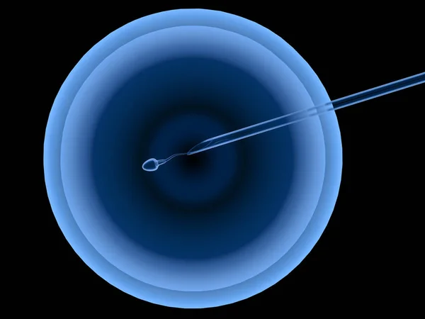 Штучне запліднення або IVf — стокове фото