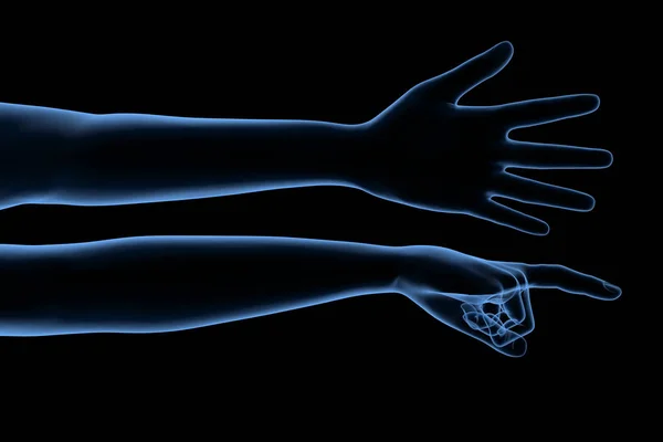 Set of human hands x-ray — 스톡 사진