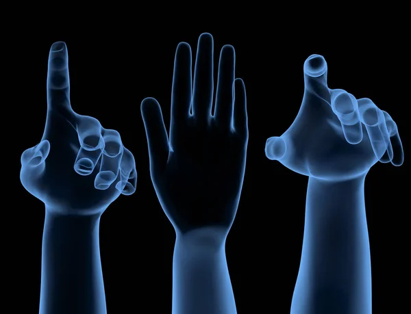 Conjunto de manos humanas rayos X — Foto de Stock