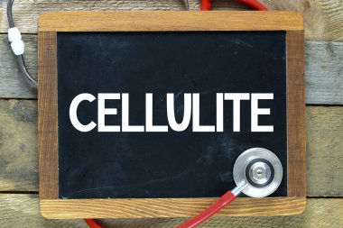 Bir kara tahta üzerinde selülit yazıt