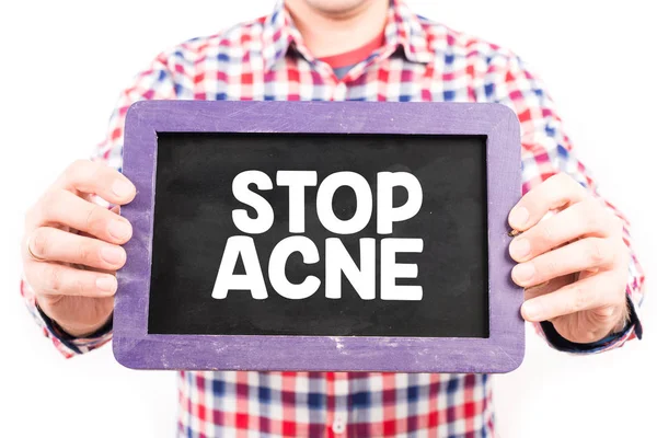 Detener banner acné —  Fotos de Stock
