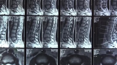 Tomografi, omurga görüntüleme. Resim. 4k.