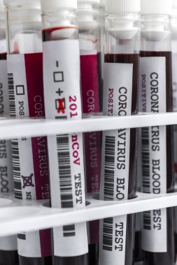 Covid-19 kan tüpleri beyaz rafta test ediliyor.