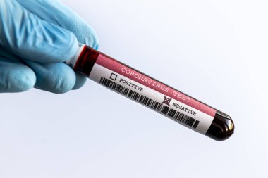 Mavi eldivenli, beyaz arka plan üzerinde negatif Covid-19 kan tüpü testi.