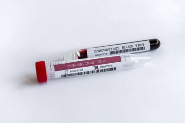 Beyaz zemin üzerinde Coronavirus kanı ve spatula testi olan iki tüp.