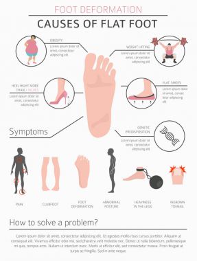 Ayak deformasyon tıbbi desease Infographic olarak. Düz nedenleri 