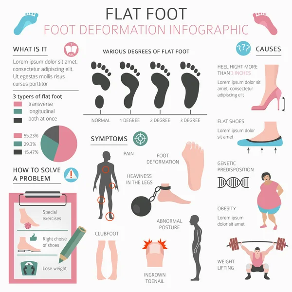 Foot deformation as medical desease infographic. Causes of Flat — Stock Vector