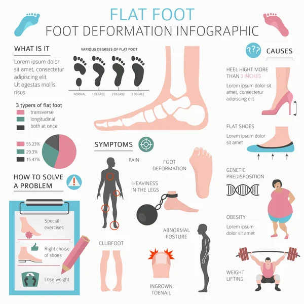 脚变形作为医疗疾病图表。平的原因 — 图库矢量图片