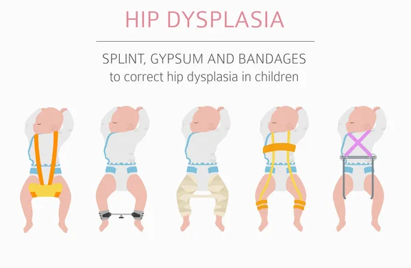 脚变形类型, 医疗疾病图表。臀部 dyspla — 图库矢量图片