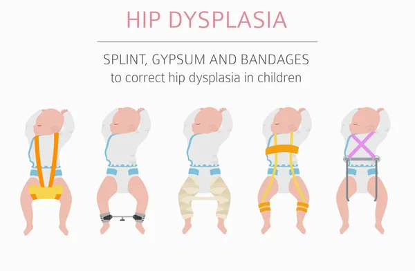 Deformasyon türleri, tıbbi desease Infographic ayak. Kalça dyspla — Stok Vektör