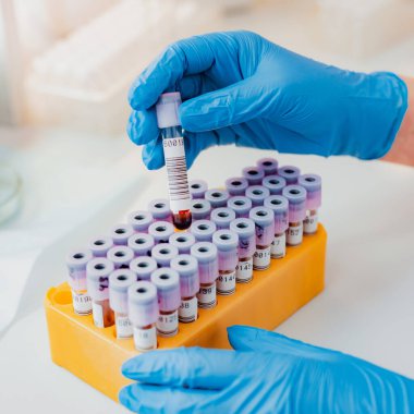 Laboratuvar asistanının elinde pipet, kan örneği tüpü ve diğer örneklerle birlikte durduğu yerde laboratuvar asistanı muayene için bir kan testi tüpü tutuyor. Virüs için bir kan testi, koronavirüs.