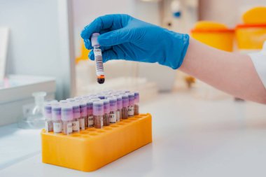Laboratuvar asistanının elinde pipet, kan örneği tüpü ve diğer örneklerle birlikte durduğu yerde laboratuvar asistanı muayene için bir kan testi tüpü tutuyor. Virüs için bir kan testi, koronavirüs.