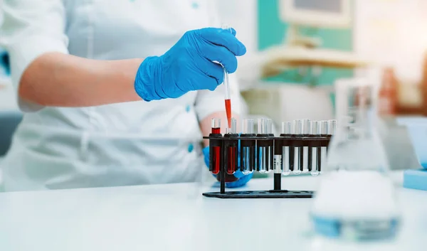 化验室助理的手用吸管 血样管和其他样品架在一起 化验室助理拿着血样试管进行检查 病毒的血液检测 考拉韦病毒 图库图片