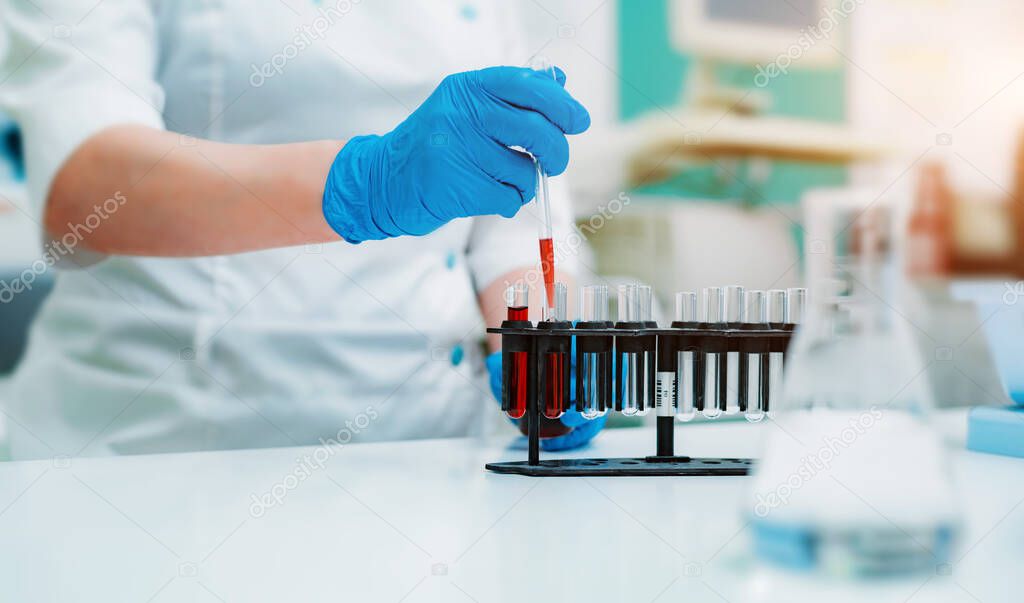 lab assistant's hands with a pipette and with a blood sample tube and a stand with other samples, the lab assistant holds a blood test tube for examination. A blood test for the virus, coronavirus