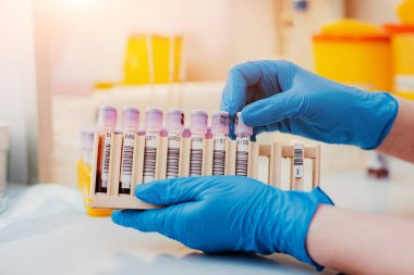 Laboratuvar asistanının elinde pipet, kan örneği tüpü ve diğer örneklerle birlikte durduğu yerde laboratuvar asistanı muayene için bir kan testi tüpü tutuyor. Virüs için bir kan testi, koronavirüs.