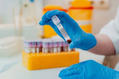 Laboratuvar asistanının elinde pipet, kan örneği tüpü ve diğer örneklerle birlikte durduğu yerde laboratuvar asistanı muayene için bir kan testi tüpü tutuyor. Virüs için bir kan testi, koronavirüs.