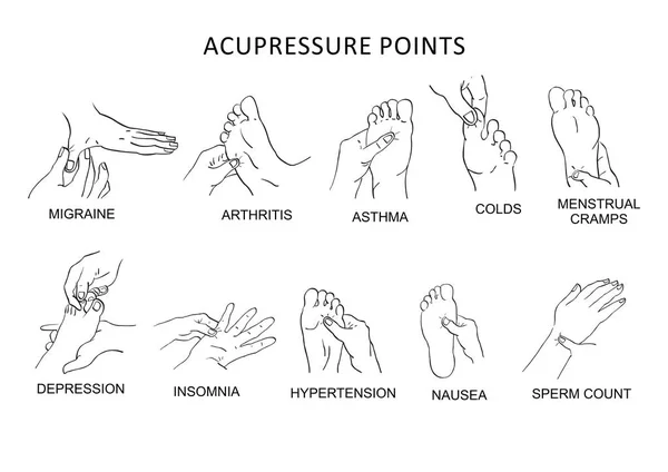 Points d'acupression pour soulager la douleur — Image vectorielle