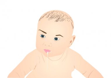 Gastroözofageal reflü bebek