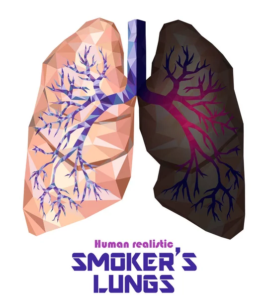 Pulmones humanos poco realistas y bronquios con inflamación del cáncer — Vector de stock