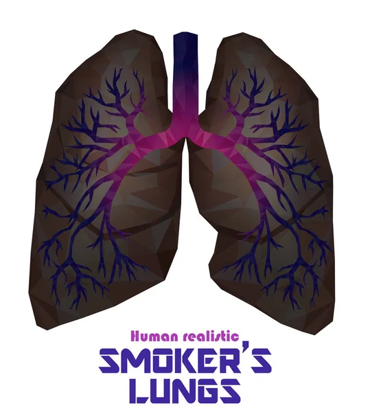 Paru-paru manusia poly realistik rendah dan bronkus dengan peradangan kanker - Stok Vektor