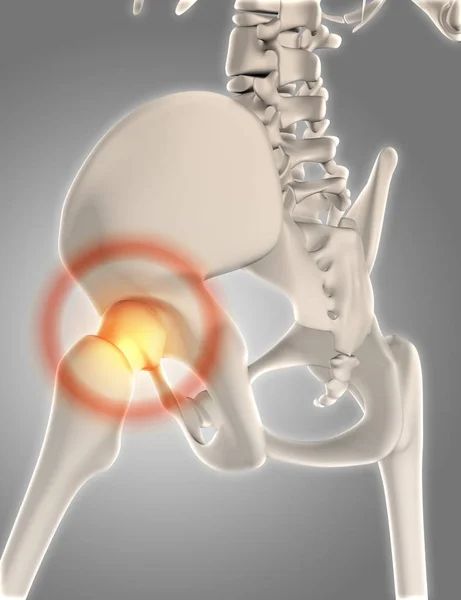 3D-skelet met hip gemarkeerd — Stockfoto