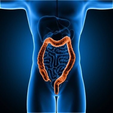 3D male medical figure with colon highlighted