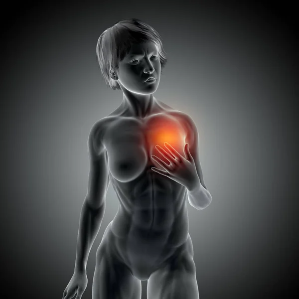 Render Medical Image Female Holding Heart Pain — Stock Photo, Image