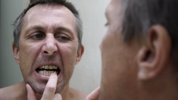 Uomo guardando nello specchio Ispezione dei denti palmare — Video Stock