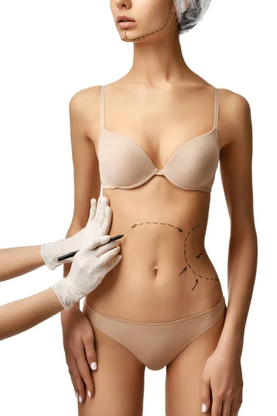 Corpo feminino com as setas de desenho na barriga para cirurgia plástica lipoaspiração — Fotografia de Stock