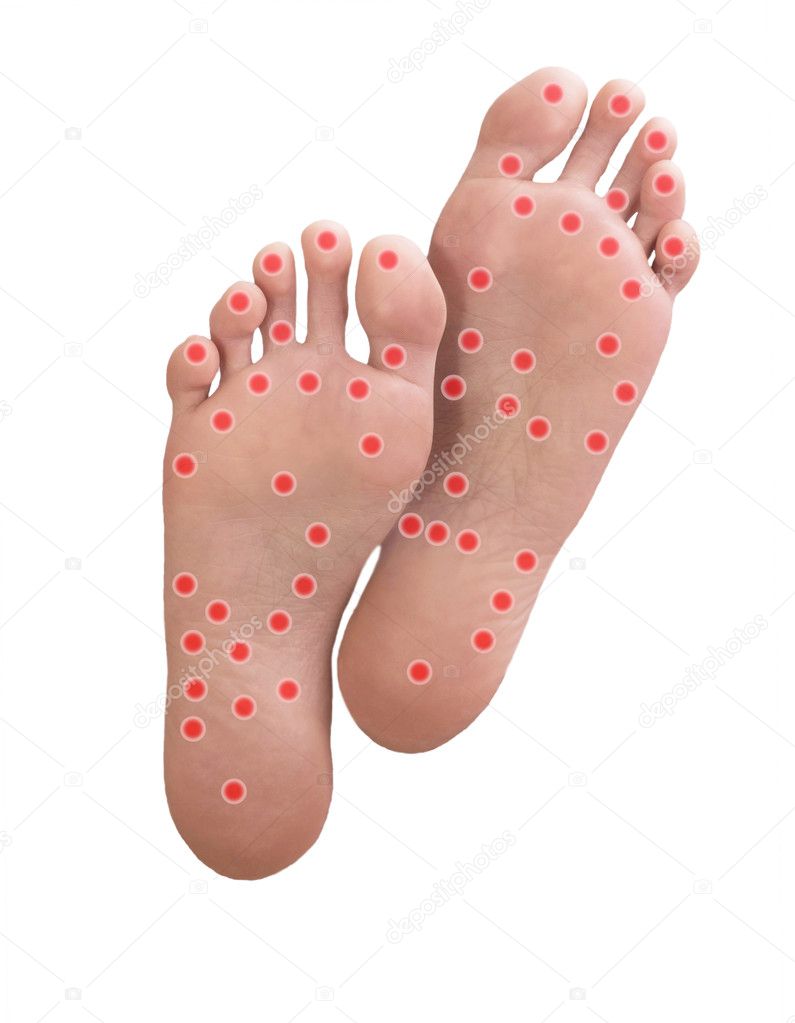 Sole of the foot with red massage points. 