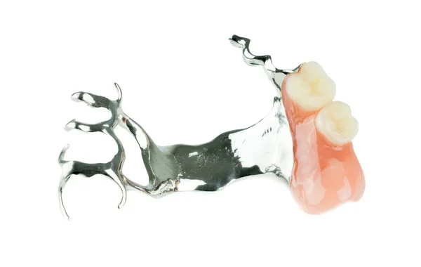 Набор частичных зубных протезов — стоковое фото