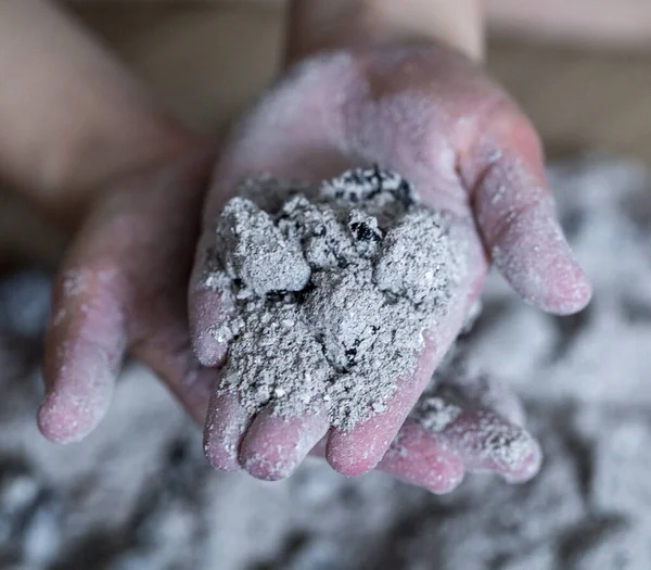 Verbrande Hand Van Een Kind — Stockfoto