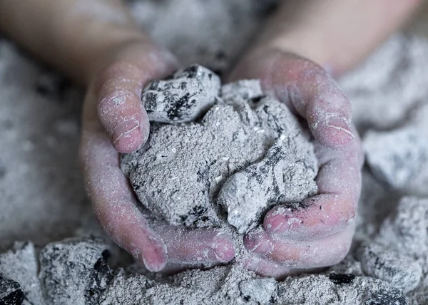 Verbrande Hand Van Een Kind — Stockfoto