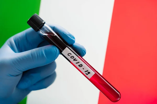 Επιδημικός Συναγερμός Ξέσπασμα Του Ιού Του Coronavirus Στην Ιταλία Δείγμα — Φωτογραφία Αρχείου