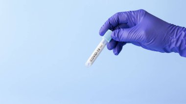 Coronavirus covid-19 numunesiyle laboratuvar teknisyeninin elinde test tüpü, ölümcül küresel salgın konsepti.