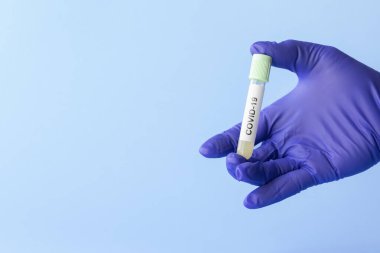 Coronavirus covid-19 numunesiyle laboratuvar teknisyeninin elinde test tüpü, ölümcül küresel salgın konsepti.