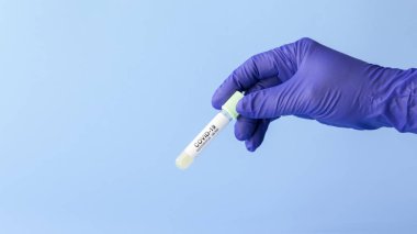Coronavirus covid-19 numunesiyle laboratuvar teknisyeninin elinde test tüpü, ölümcül küresel salgın konsepti.