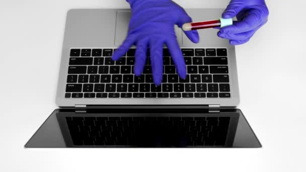 라텍스 장갑을 샘플로 시험관을 실험실 기술자 노트북 컴퓨터를 사용하여 환자의 — 비디오