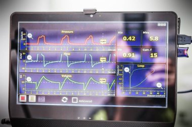 mekanik havalandırma donatımı