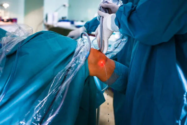 Chirurgia del ginocchio, operazione ortopedica - due chirurghi che eseguono un — Foto Stock