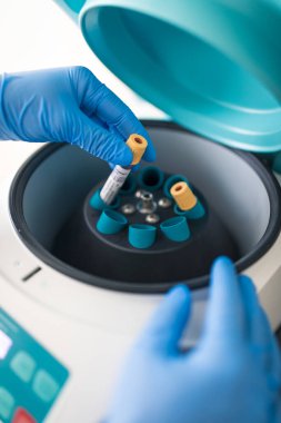 Ölümcül virüs salgınının ortasında kan testi yapan bir hemşire.