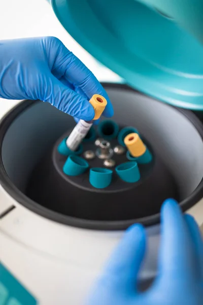 Nurse Lab Carrying Out Blood Test Deadly Virus Pandemic — Stock Photo, Image